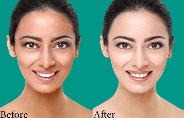 قیمت بهترین کرم سفید کننده صورت 